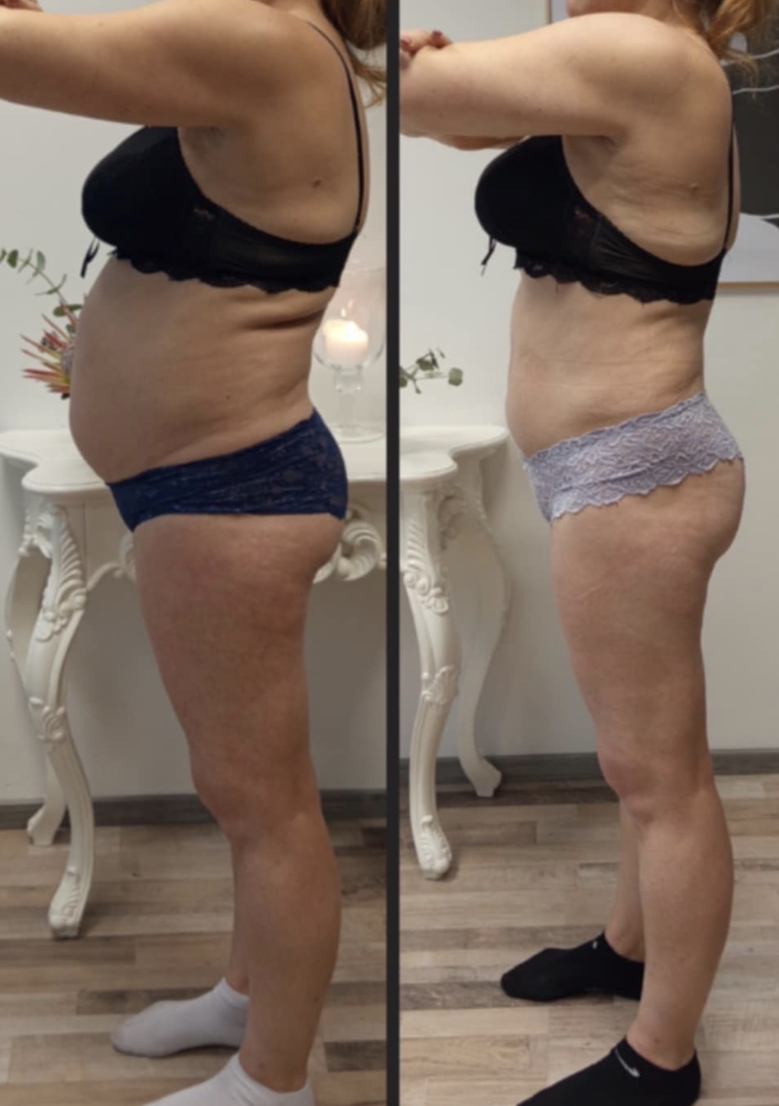 lpg, xbody, kaalu langetus, kiirelt vormi